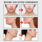 100-Piece Face Lifting Tape Kit