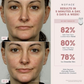 Mini Facial Toning Device – Microcurrent Wrinkle Reducer & Skin Lifting Tool